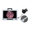 EickView 4-in-1 Endoscopy Monitor incl. a high-resolution CCD camera and LED cold light source