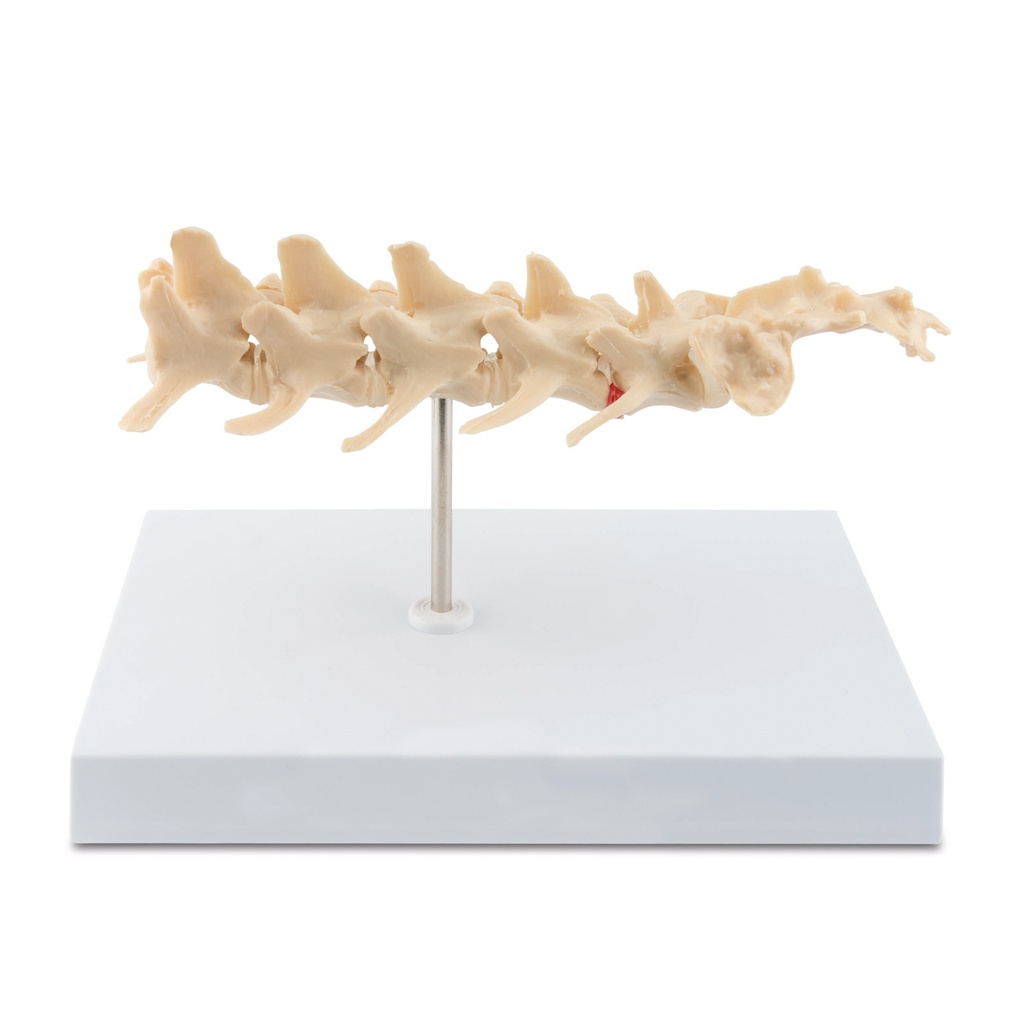 Osteo-Model: Spinal  