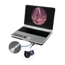 EickView 4-in-1 compact endoscopy system