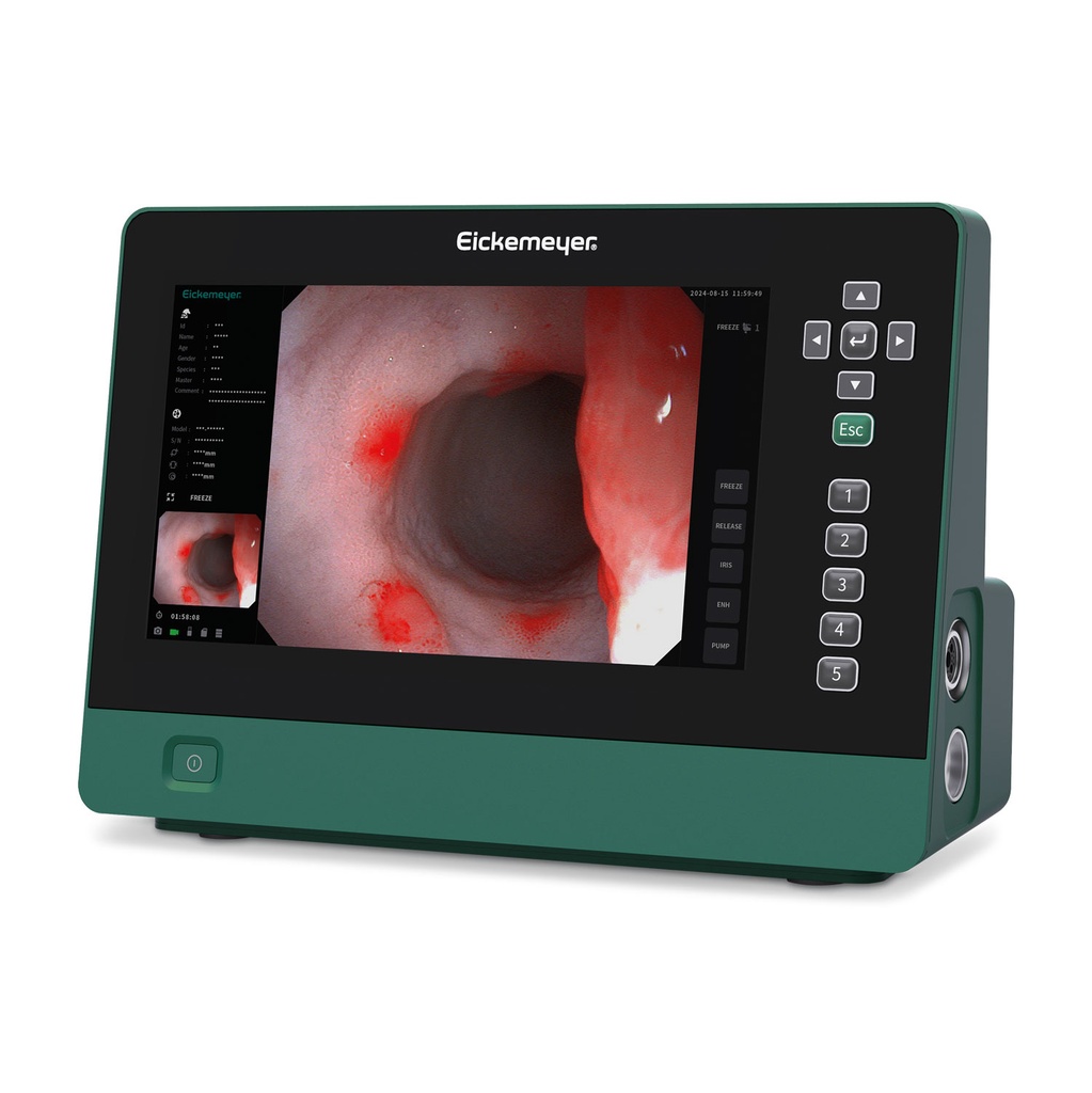 EickView 5-in-1 endoscopy system