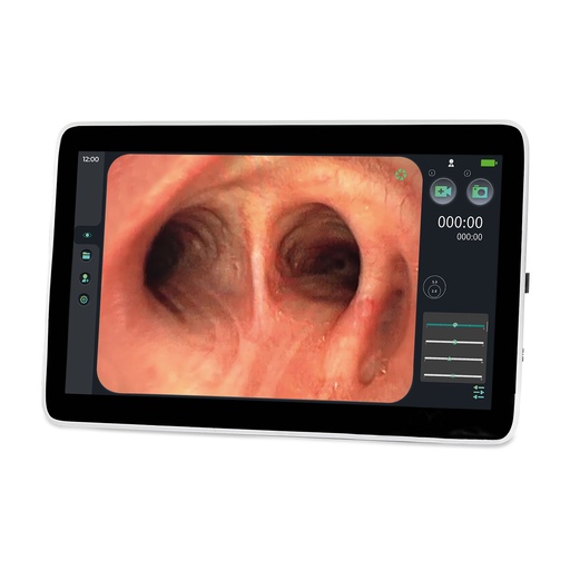 [307000] EickView SD endoscopy monitor, 15.6" touchscreen